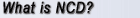 What is NCD